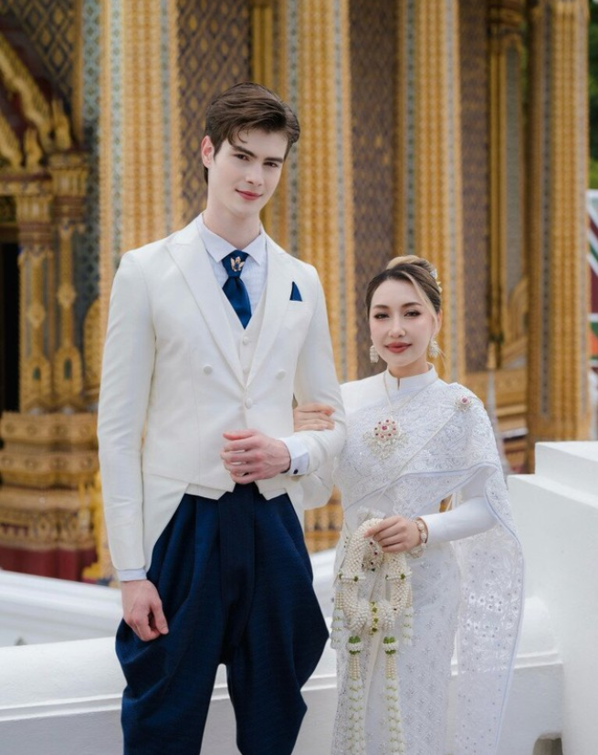 Gương mặt sau 21 ng&agrave;y phẫu thuật thẩm mỹ của c&ocirc; vợ cao 1m55 &aacute;p lực v&igrave; chồng T&acirc;y qu&aacute; đẹp trai, cao gần 2m- Ảnh 2.