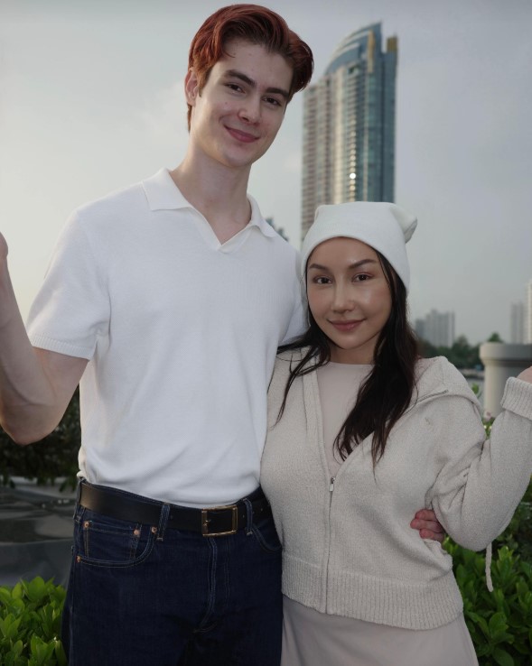 Gương mặt sau 21 ng&agrave;y phẫu thuật thẩm mỹ của c&ocirc; vợ cao 1m55 &aacute;p lực v&igrave; chồng T&acirc;y qu&aacute; đẹp trai, cao gần 2m- Ảnh 10.