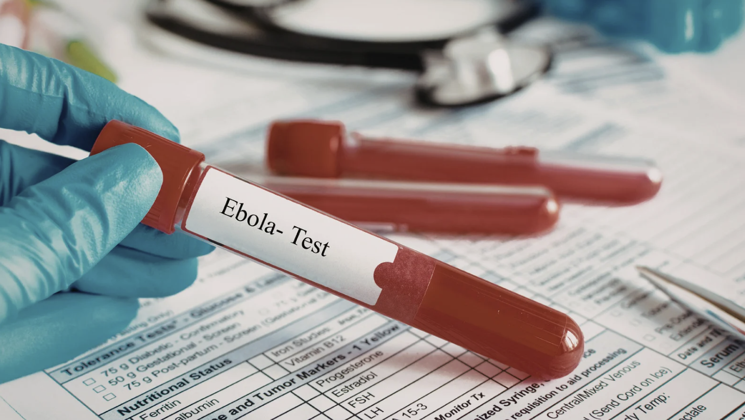 TPHCM tăng cường gi&aacute;m s&aacute;t cửa khẩu, chủ động ph&ograve;ng nguy cơ dịch Ebola x&acirc;m nhập - Ảnh 1.