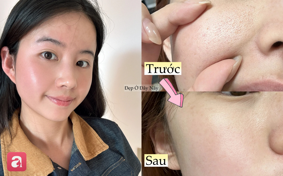 L&agrave;n da sần s&ugrave;i, lỗ ch&acirc;n l&ocirc;ng to của n&agrave;ng blogger đ&atilde; thay đổi ho&agrave;n to&agrave;n nhờ c&aacute;ch chăm da &iacute;t người ch&uacute; &yacute; - Ảnh 1.