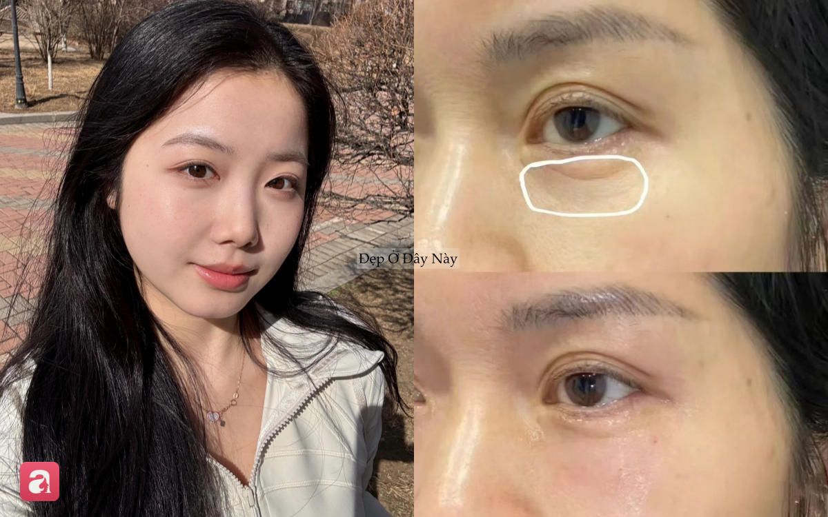 5 lọ kem mắt chứa retinol l&agrave; "thần dược" cho những n&agrave;ng ngo&agrave;i 30 tuổi- Ảnh 1.