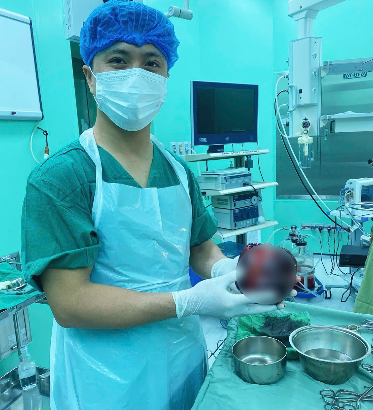 Đau bụng tưởng nhẹ, người đ&agrave;n &ocirc;ng "sốc nặng" khi ph&aacute;t hiện thứ "đ&aacute;ng sợ" to bằng quả dưa lưới- Ảnh 1.