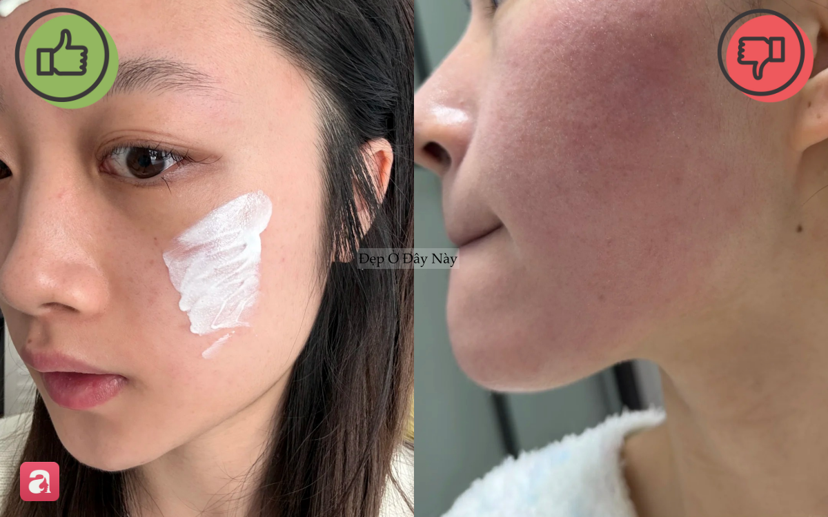5 m&oacute;n skincare quan trọng bậc nhất trong m&ugrave;a h&egrave; m&agrave; nhiều người thường lơ l&agrave; bỏ qua - Ảnh 2.