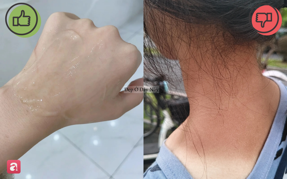 5 m&oacute;n skincare quan trọng bậc nhất trong m&ugrave;a h&egrave; m&agrave; nhiều người thường lơ l&agrave; bỏ qua - Ảnh 6.