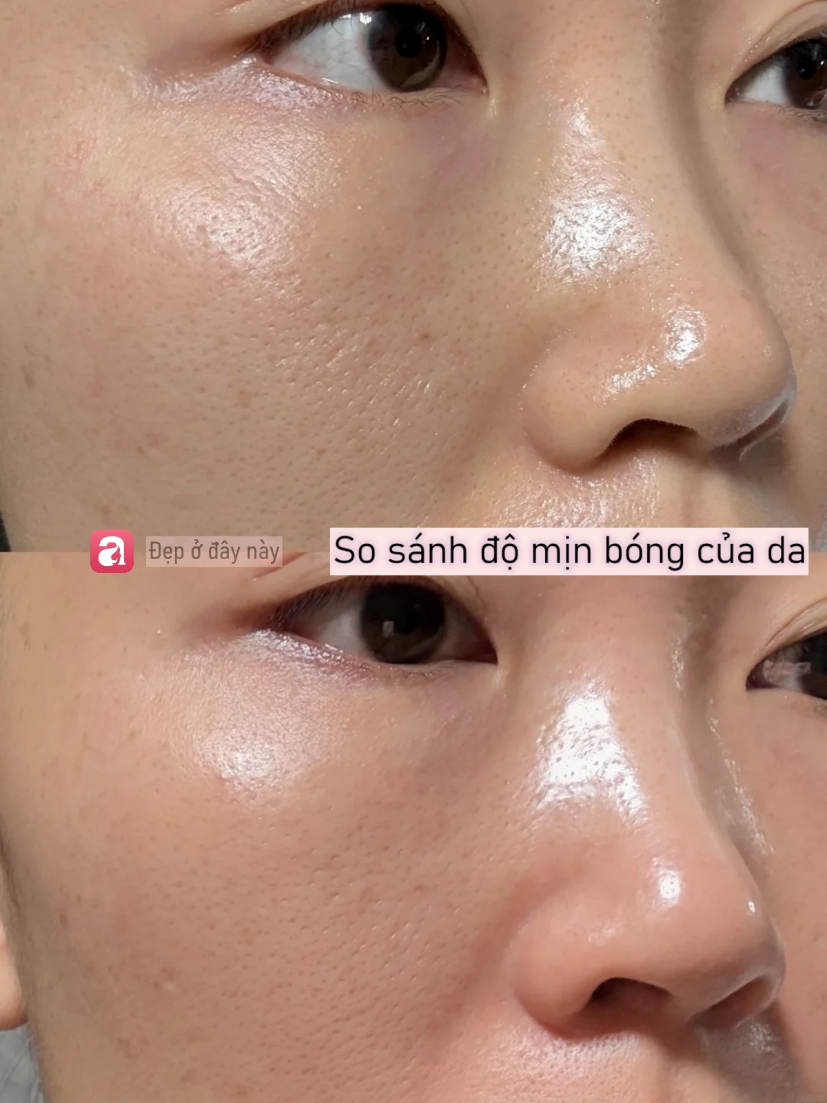 Da b&oacute;ng v&agrave; l&aacute;ng căng sau 3 ph&uacute;t d&ugrave;ng acid nồng độ 30%, nhưng sự thật kh&ocirc;ng đơn giản như t&ocirc;i nghĩ - Ảnh 4.