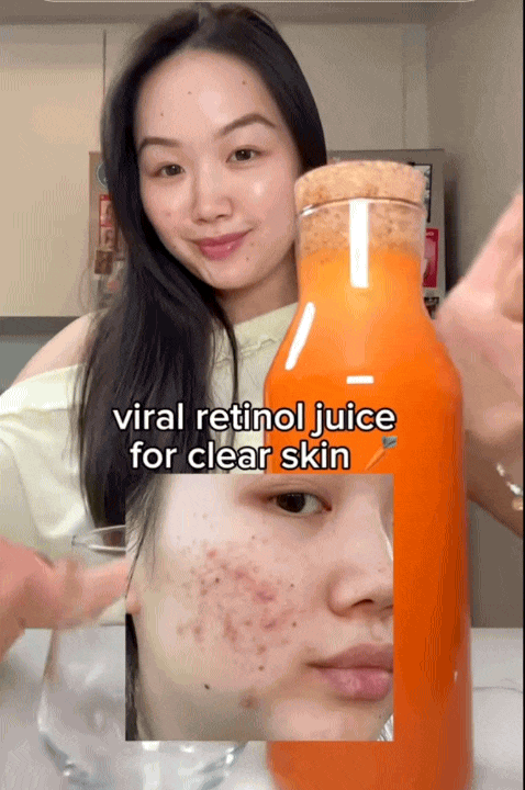 Để cứu l&agrave;n da chi ch&iacute;t mụn, c&ocirc; n&agrave;ng H&agrave;n Quốc uống loại nước &eacute;p đẹp da uống 2 lần/tuần, kết quả da đẹp ngo&agrave;i sức tưởng tượng- Ảnh 4.