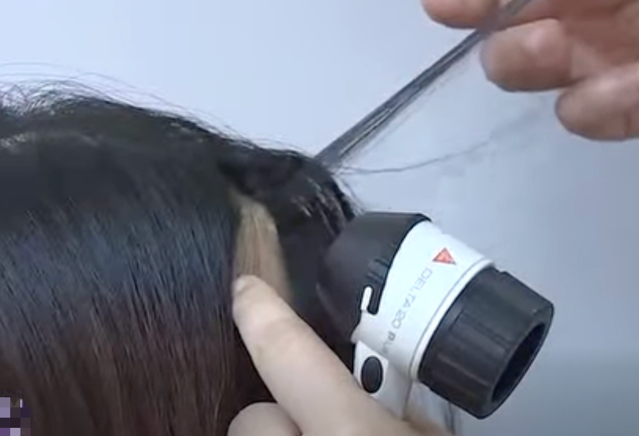 Người trẻ rụng t&oacute;c, h&oacute;i đầu v&igrave; những th&oacute;i quen tưởng v&ocirc; hại - Ảnh 3.