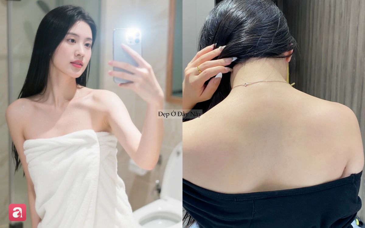 D&agrave;nh cho người mụn lưng: 5 sữa tắm "made in Vietnam" l&agrave;m sạch s&acirc;u, giảm mụn m&agrave; kh&ocirc;ng g&acirc;y kh&ocirc; da - Ảnh 1.