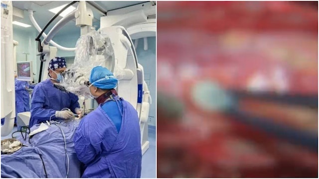 Người phụ nữ đau lưng suốt 2 năm, b&aacute;c sĩ ph&aacute;t hiện ra b&iacute; mật "đ&aacute;ng sợ" - Ảnh 1.