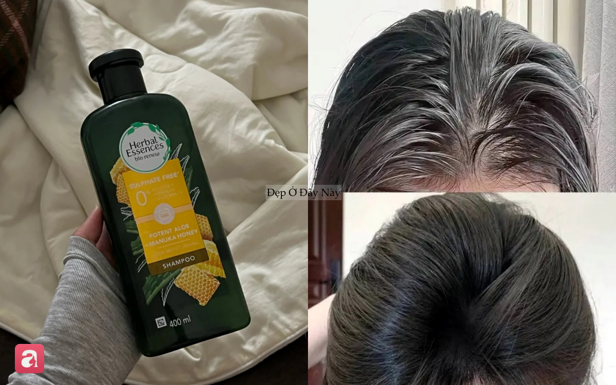 M&aacute;i t&oacute;c kh&ocirc; xơ, thưa rụng của t&ocirc;i đ&atilde; thay đổi bất ngờ nhờ ki&ecirc;n tr&igrave; với 5 m&oacute;n n&agrave;y- Ảnh 3.