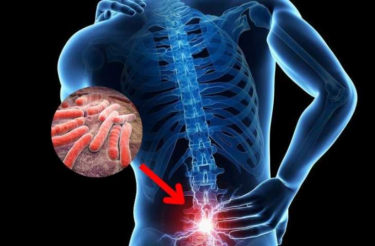 Người đ&agrave;n &ocirc;ng 53 tuổi đột ngột bị liệt v&agrave;o buổi s&aacute;ng, b&aacute;c sĩ chỉ r&otilde; "sai lầm ch&iacute; mạng"- Ảnh 1.