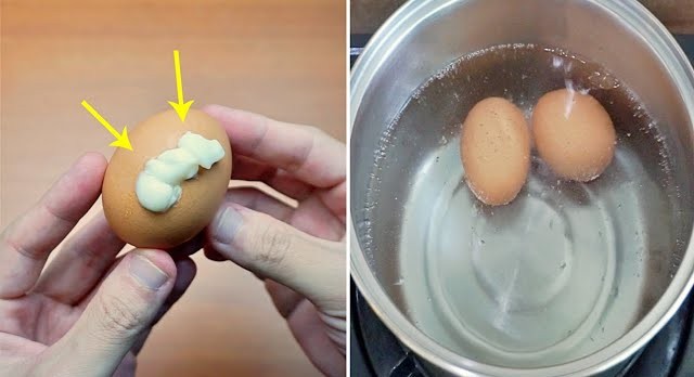 Tiktoker nổi tiếng vì ăn 40 quả trứng mỗi ngày trong 5 năm, bác sĩ hoảng hốt: Đi khám ngay còn kịp! - Ảnh 1.
