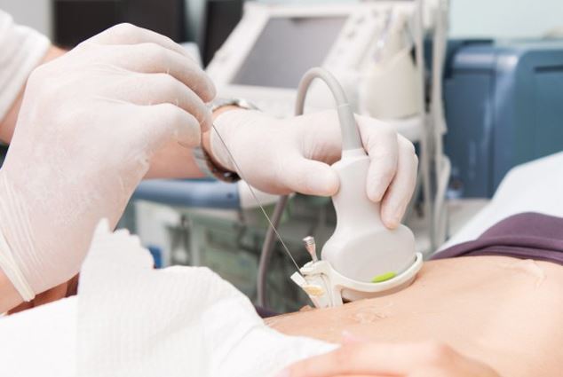 Bỏ qua 2 triệu chứng kh&ocirc;ng đau, người đ&agrave;n &ocirc;ng 60 tuổi ph&aacute;t hiện ung thư gan giai đoạn cuối- Ảnh 2.