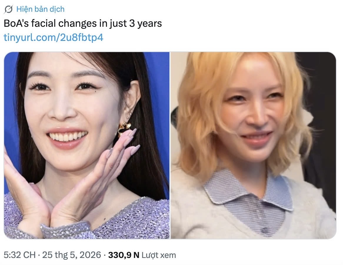 Nữ ho&agrave;ng Kpop kh&ocirc;ng c&ograve;n trẻ đẹp?- Ảnh 1.