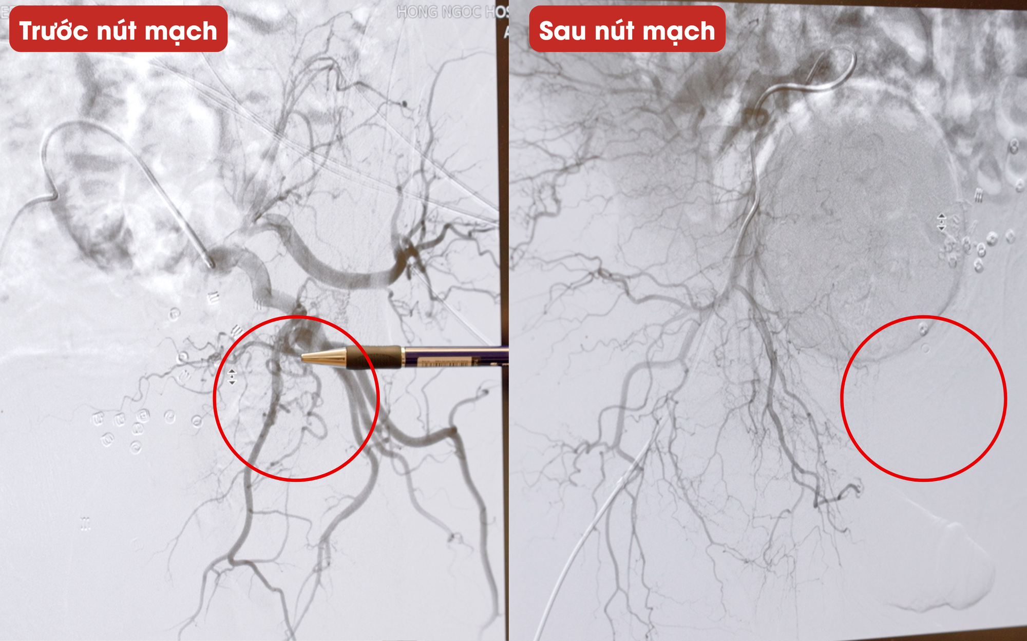 Kh&aacute;ch T&acirc;y l&agrave; nhạc sĩ sang 1 bệnh viện ở Việt Nam chữa đi tiểu 20 ph&uacute;t/lần: "B&acirc;y giờ t&ocirc;i thấy m&igrave;nh đang ở trong 1 cơ thể mới" - Ảnh 3.