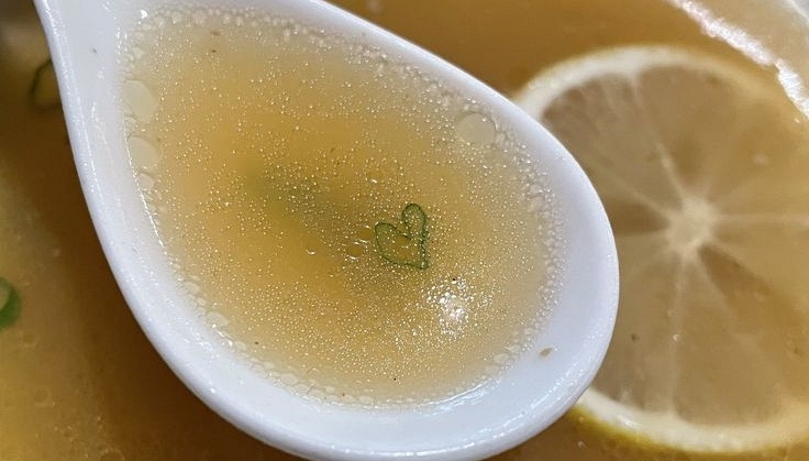 Tưởng đau bụng th&ocirc;ng thường, người đ&agrave;n &ocirc;ng 67 tuổi mang trong m&igrave;nh thứ "đ&aacute;ng sợ" khiến b&aacute;c sĩ sốc ngang - Ảnh 3.