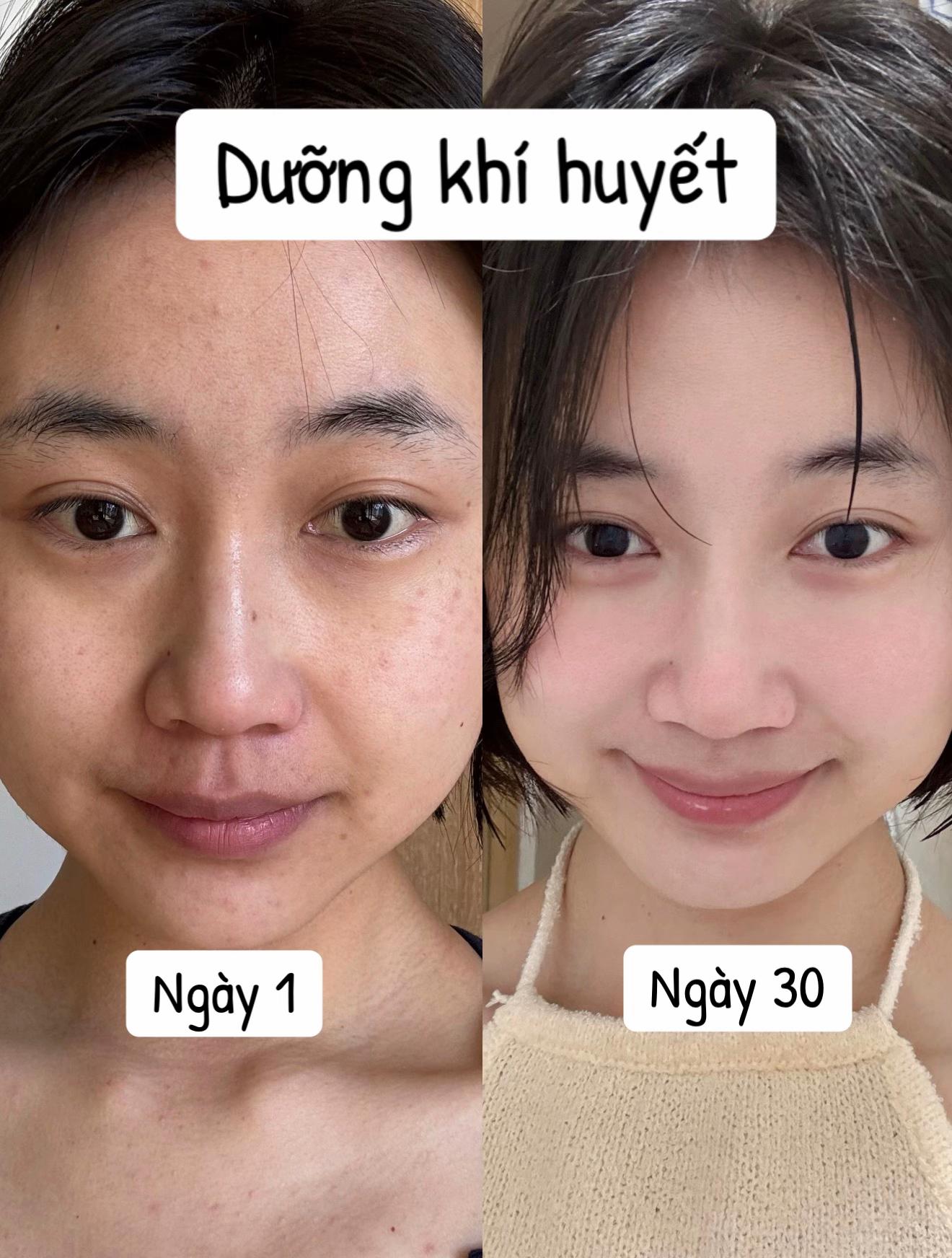 Phụ nữ sau tuổi 35 dưỡng nhan theo c&aacute;ch n&agrave;y: 30 ng&agrave;y l&agrave; thấy da hồng h&agrave;o, thần sắc tươi tắn thấy r&otilde;- Ảnh 10.