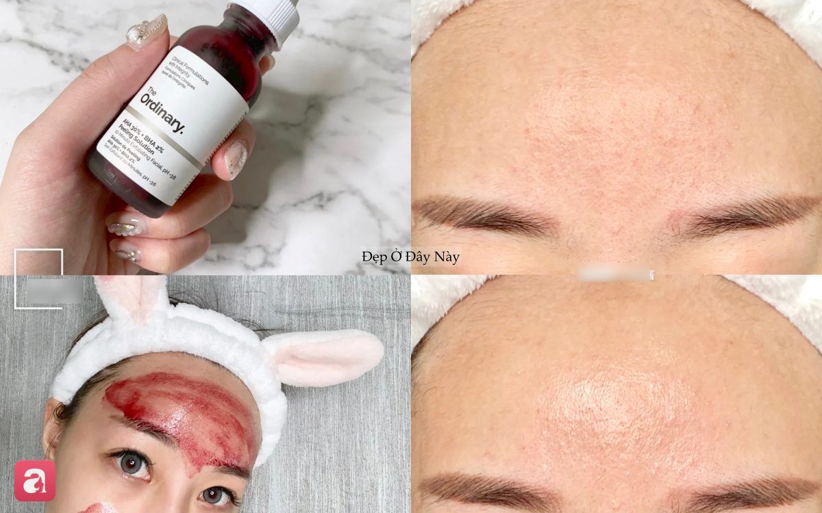 Loại serum "thần kỳ": D&ugrave;ng mỗi tuần 1 lần, l&agrave;n da được "t&aacute;i sinh" như đi spa về- Ảnh 2.