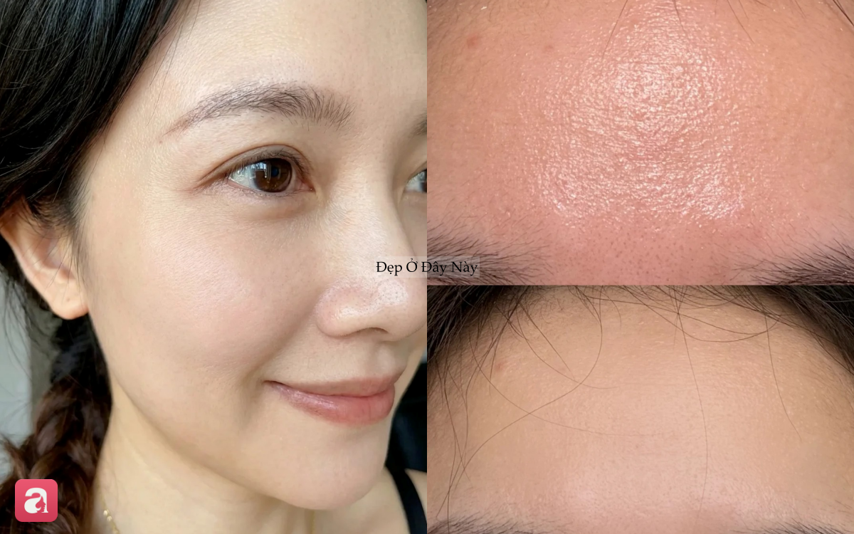 Loại serum "thần kỳ": D&ugrave;ng mỗi tuần 1 lần, l&agrave;n da được "t&aacute;i sinh" như đi spa về- Ảnh 4.