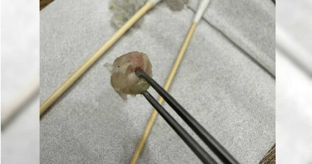 B&eacute; g&aacute;i 6 tuổi đau khổ v&igrave; nghẹt mũi, sự thật b&ecirc;n trong khiến bố mẹ "hoảng sợ" - Ảnh 1.