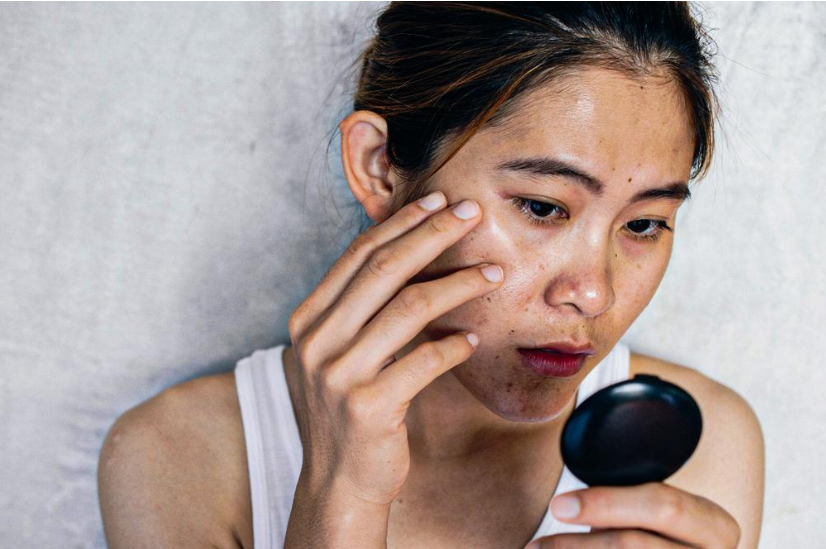 Nh&igrave;n mặt đo&aacute;n bệnh gan, b&aacute;c sĩ: Người bị bệnh gan c&oacute; 5 điểm bất thường tr&ecirc;n khu&ocirc;n mặt- Ảnh 3.
