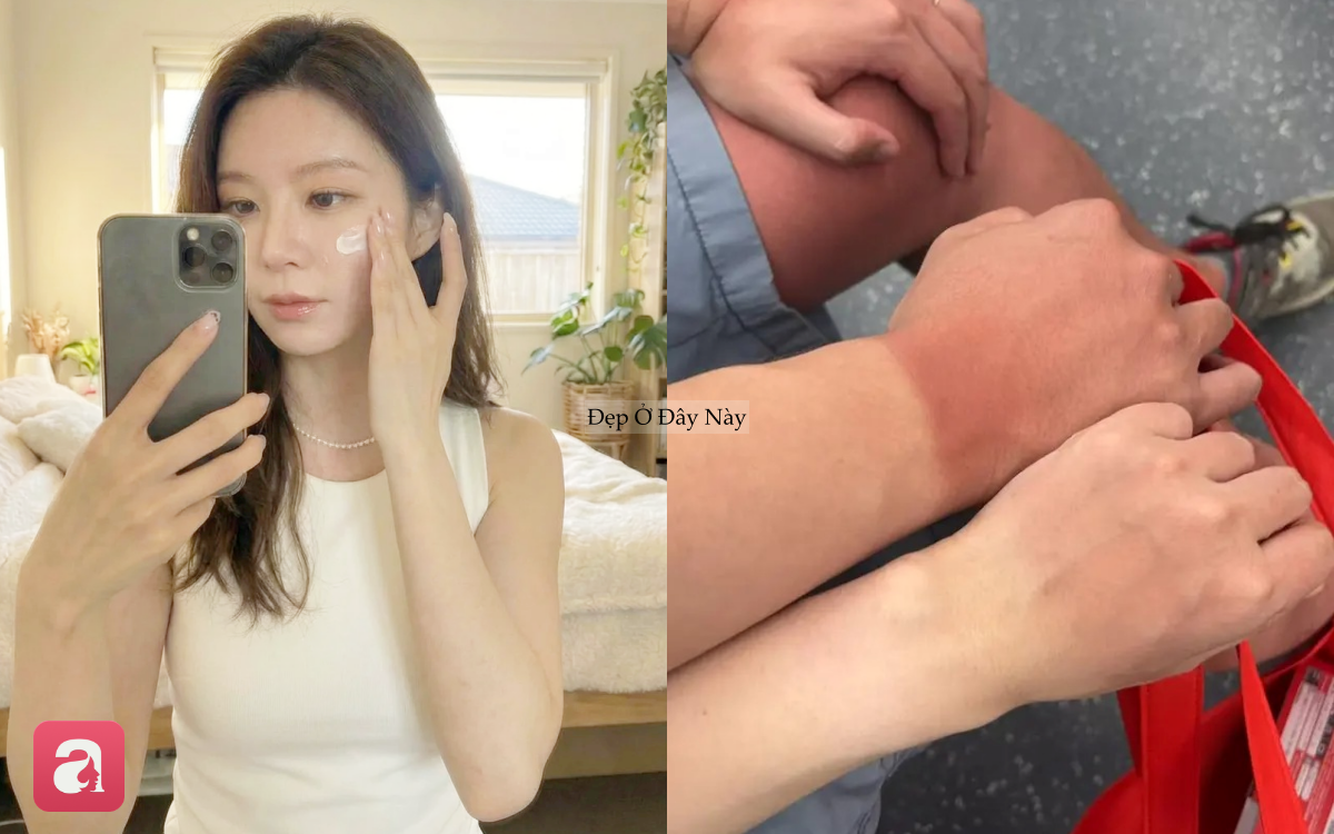 B&ocirc;i kem chống nắng kiểu n&agrave;y, da kh&ocirc;ng chỉ sạm đen m&agrave; c&ograve;n l&atilde;o h&oacute;a nhanh- Ảnh 1.