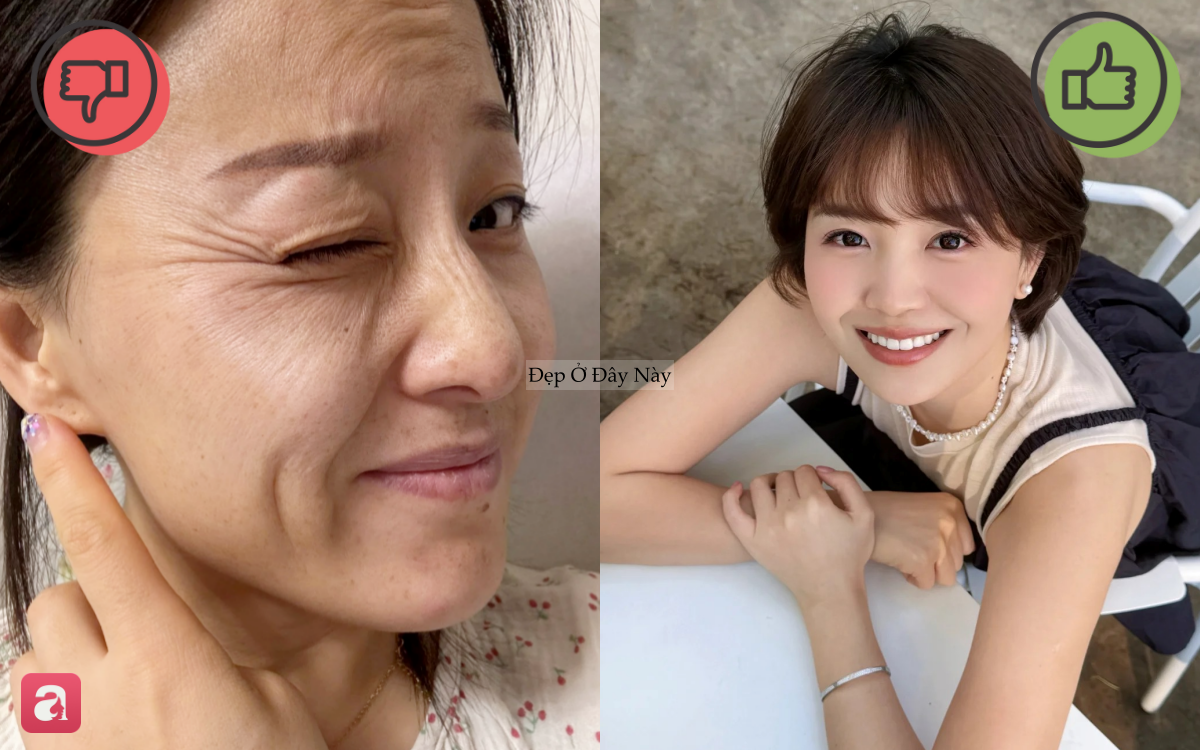 6 th&oacute;i quen tai hại khiến nếp nhăn v&ugrave;ng mắt ng&agrave;y c&agrave;ng hằn s&acirc;u, đẩy nhanh l&atilde;o h&oacute;a- Ảnh 1.