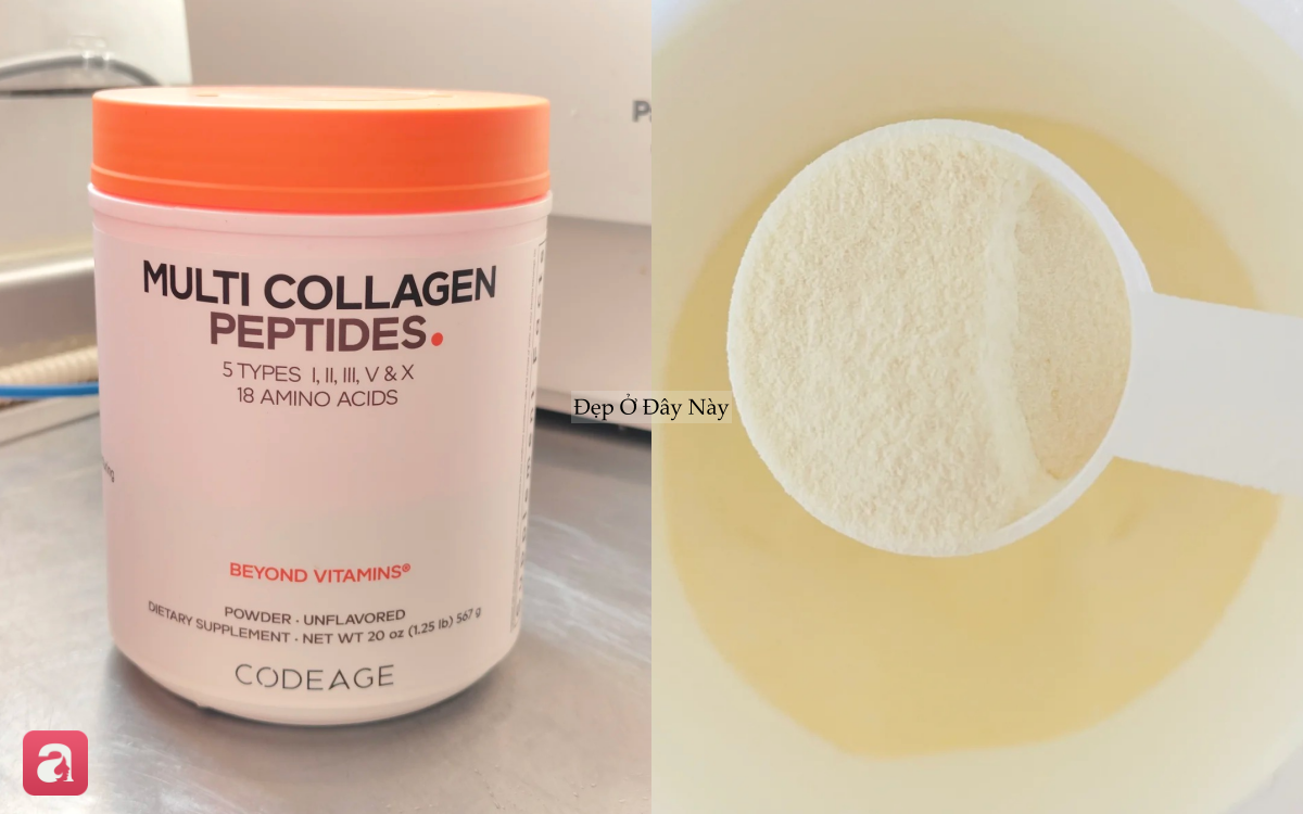 5 lọ bột collagen từ b&igrave;nh d&acirc;n tới cao cấp, d&ugrave;ng 1 th&igrave;a mỗi ng&agrave;y sẽ thấy nếp nhăn li ti dần biến mất- Ảnh 2.