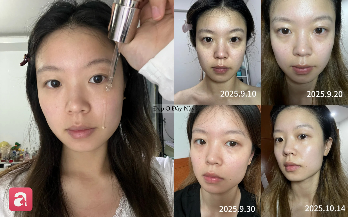 1 th&aacute;ng d&ugrave;ng serum vitamin C, l&agrave;n da của n&agrave;ng blogger như "thay da đổi thịt" ho&agrave;n to&agrave;n - Ảnh 1.