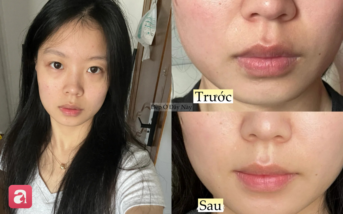 1 th&aacute;ng d&ugrave;ng serum vitamin C, l&agrave;n da của n&agrave;ng blogger như "thay da đổi thịt" ho&agrave;n to&agrave;n - Ảnh 2.