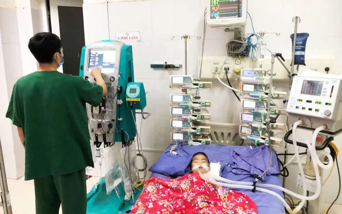 C&aacute;c b&aacute;c sĩ lọc m&aacute;u điều trị cho bệnh nhi mắc tay ch&acirc;n miệng độ 4. Ảnh: BVCC