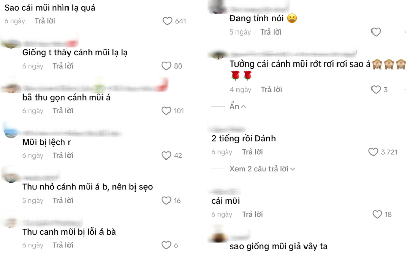 Chiếc mũi bất thường của Uyển &Acirc;n- Ảnh 3.