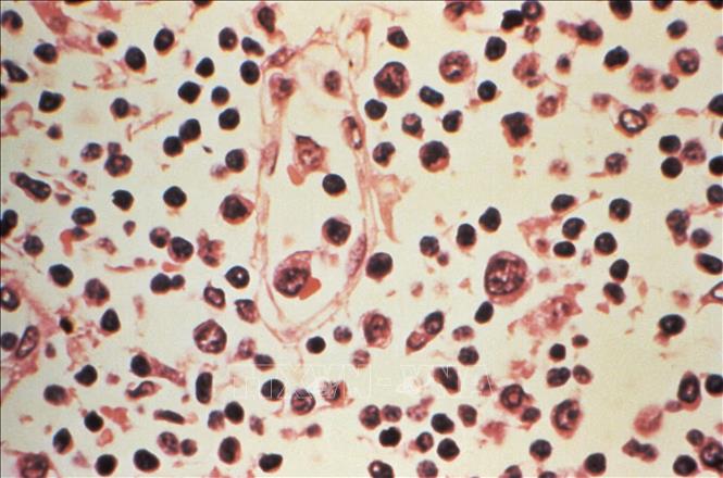Đ&agrave;i Loan ghi nhận 1 ca tử vong&nbsp;do nhiễm virus Hanta- Ảnh 1.
