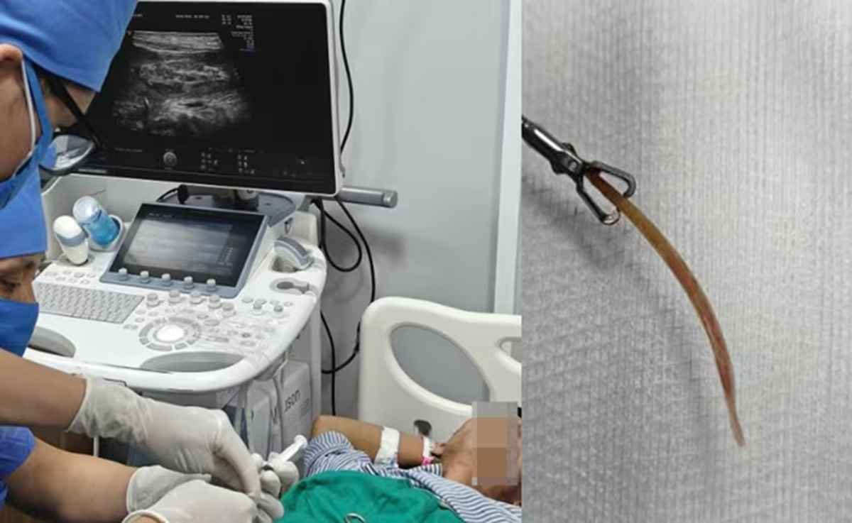 Đau bụng nhiều ng&agrave;y tưởng nhẹ, đi kh&aacute;m người đ&agrave;n &ocirc;ng "sốc" nặng khi biết b&iacute; mật - Ảnh 1.
