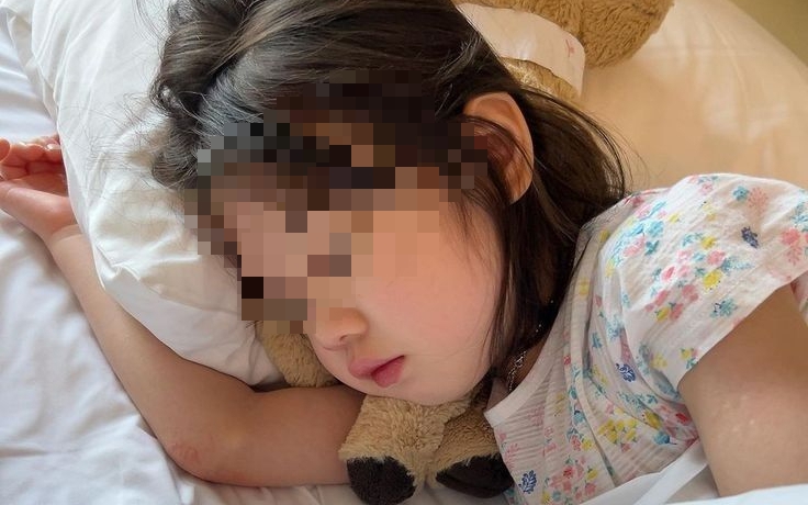 Gan nhiễm mỡ rất &ldquo;sợ&rdquo; tất cả những ai thường xuy&ecirc;n l&agrave;m 5 điều n&agrave;y - Ảnh 2.