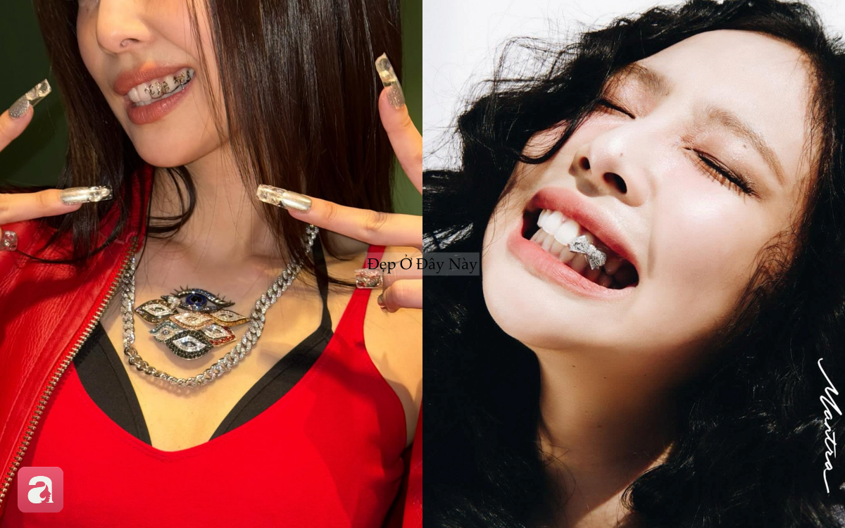 Chiếc bọc răng của Jennie c&oacute; g&igrave; đặc biệt m&agrave; khiến fan ch&uacute; &yacute; hơn cả v&ograve;ng cổ 1,2 tỷ đồng?- Ảnh 6.