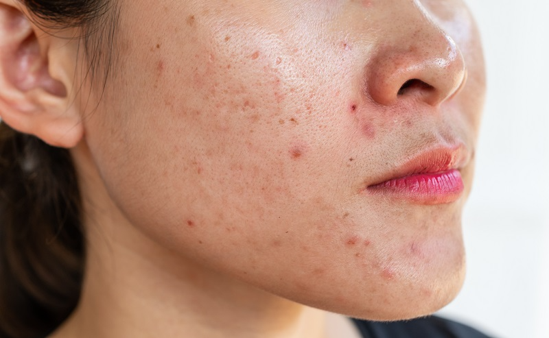 6 tu&yacute;p kem được chuy&ecirc;n gia da liễu H&agrave;n Quốc đ&aacute;nh gi&aacute; cao - Ảnh 3.
