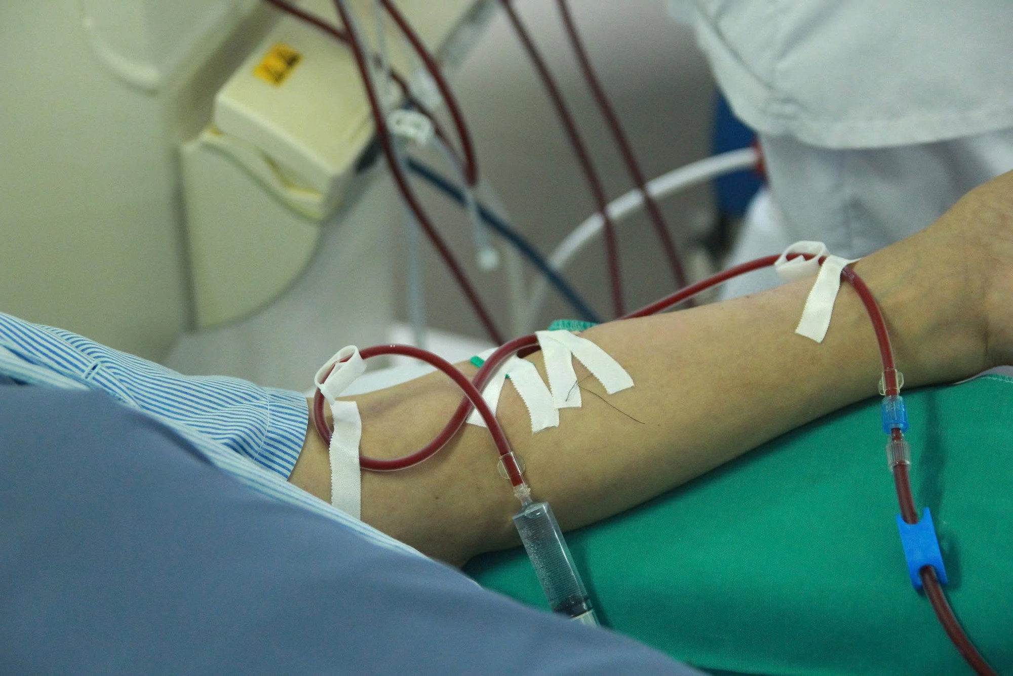 Ch&agrave;ng trai 21 tuổi suy thận, nguy cơ chạy thận cả đời, được bệnh viện tuyến tỉnh l&agrave;m 1 việc m&agrave; thay đổi cả số phận - Ảnh 2.
