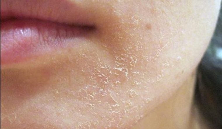 6 tu&yacute;p kem được chuy&ecirc;n gia da liễu H&agrave;n Quốc đ&aacute;nh gi&aacute; cao - Ảnh 5.