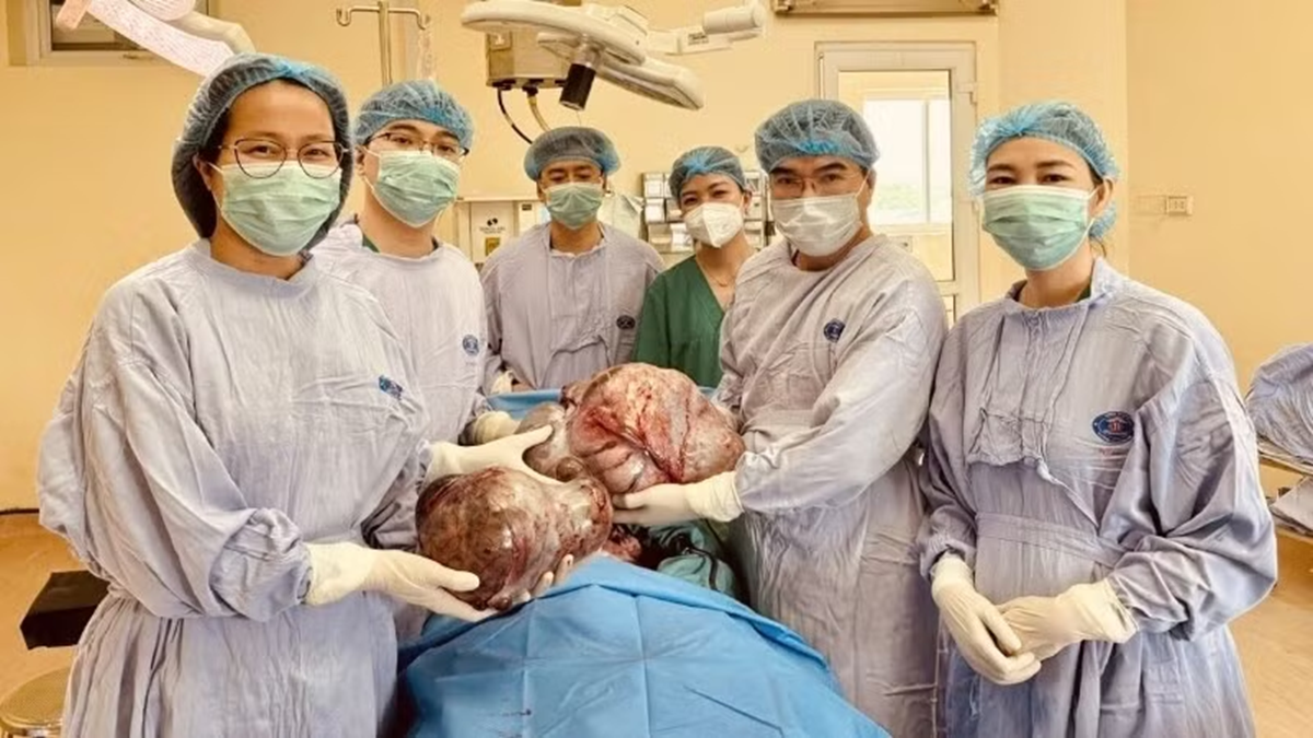 B&eacute; g&aacute;i 16 tuổi bụng to bất thường, bố mẹ sốc khi ph&aacute;t hiện b&iacute; mật "đ&aacute;ng sợ" b&ecirc;n trong - Ảnh 1.