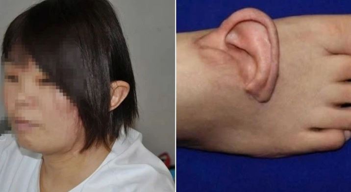 Người phụ nữ "mọc" tai tr&ecirc;n b&agrave;n ch&acirc;n v&agrave; sự thật bất ngờ - Ảnh 1.