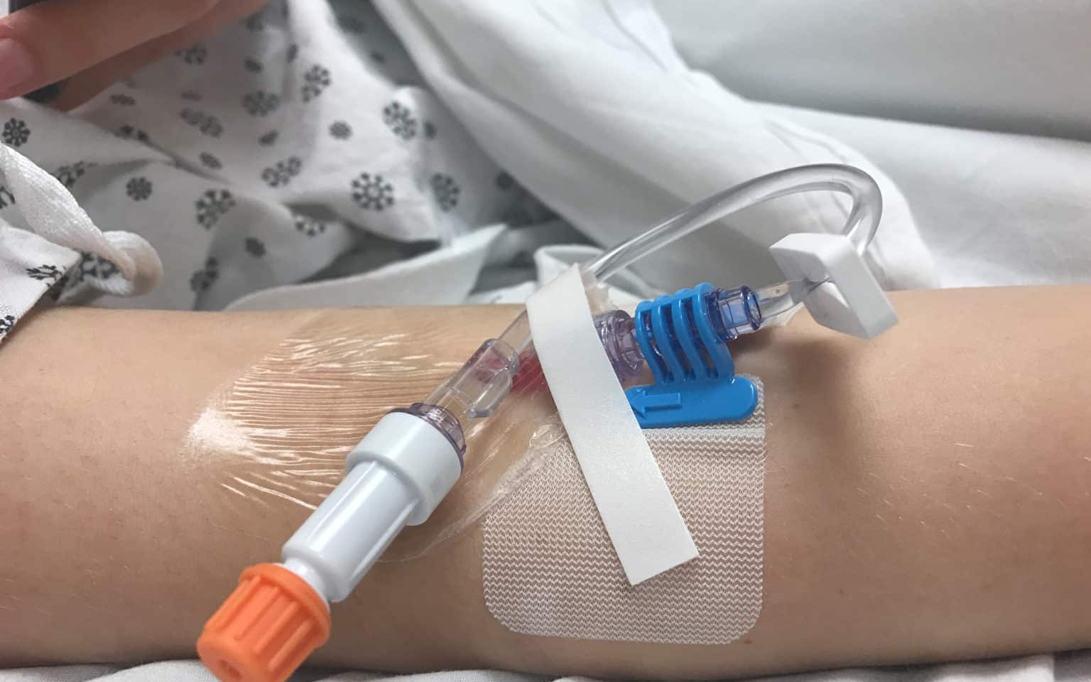 B&eacute; g&aacute;i 12 tuổi mắc "hội chứng người h&oacute;a đ&aacute;" hiếm gặp, bố mẹ ngỡ ng&agrave;ng khi b&aacute;c sĩ nhắc tới c&uacute; ng&atilde; xe đạp 2 năm trước - Ảnh 2.