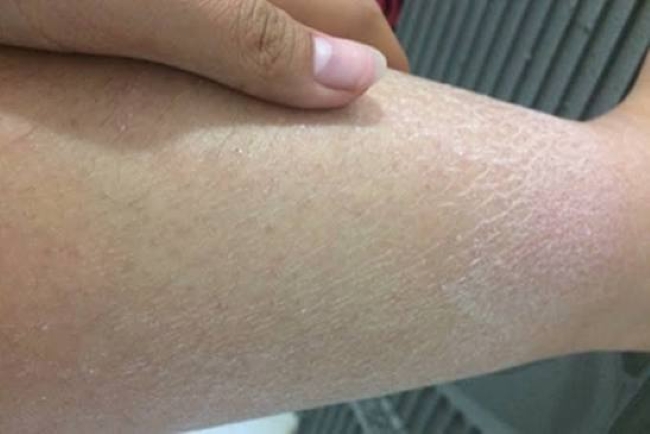C&aacute;c b&aacute;c sĩ n&oacute;i thẳng: Bắp ch&acirc;n l&agrave; "đ&egrave;n b&aacute;o" đột quỵ, thấy 5 thứ phải đến bệnh viện ngay!- Ảnh 4.