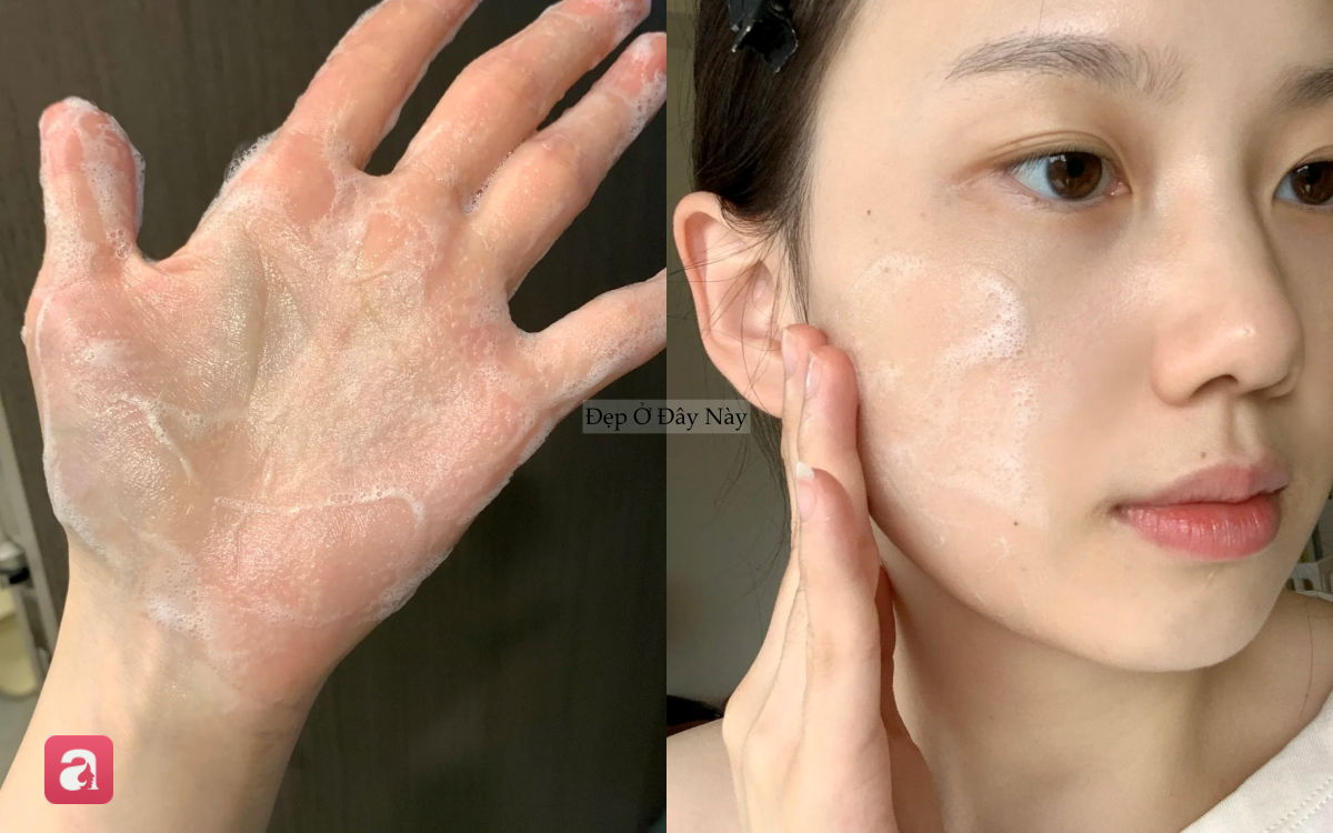 B&aacute;c sĩ da liễu chỉ ra c&aacute;ch rửa mặt gi&uacute;p da đẹp l&ecirc;n thấy r&otilde; chỉ sau 30 gi&acirc;y- Ảnh 3.