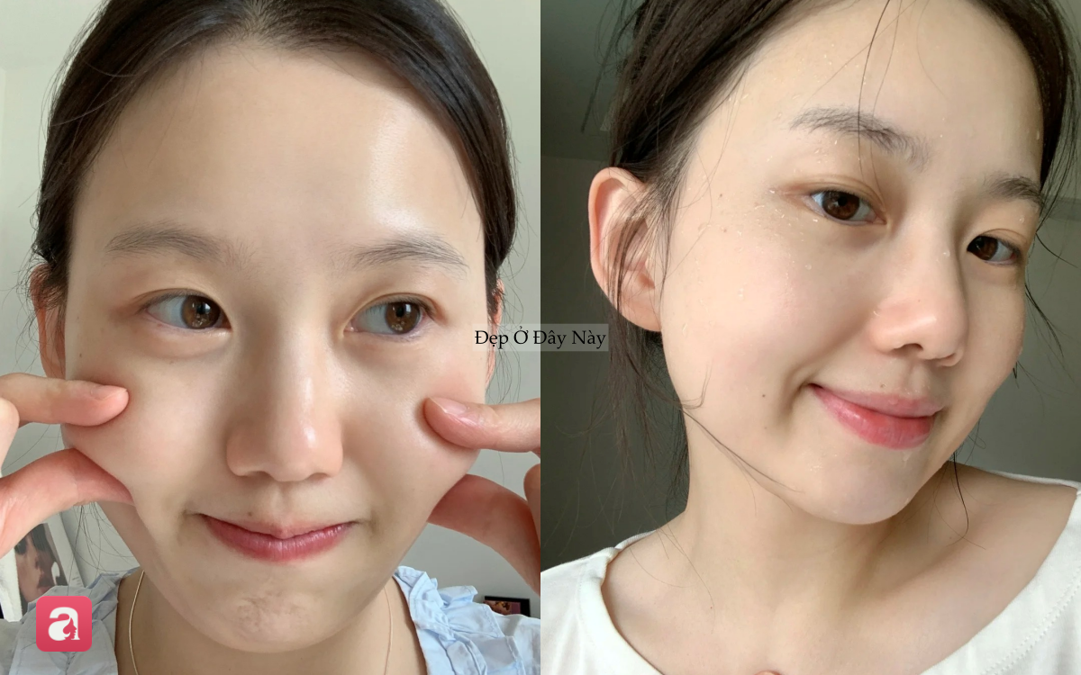 B&aacute;c sĩ da liễu chỉ ra c&aacute;ch rửa mặt gi&uacute;p da đẹp l&ecirc;n thấy r&otilde; chỉ sau 30 gi&acirc;y- Ảnh 4.
