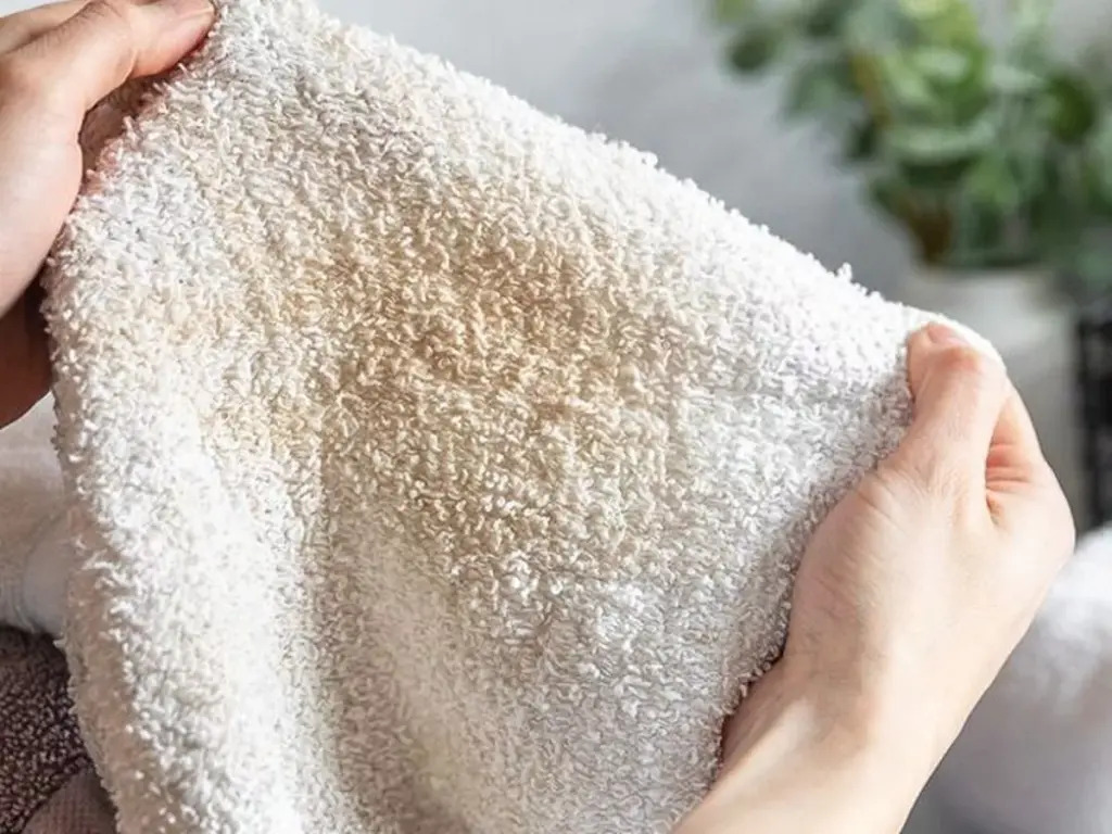 B&aacute;c sĩ da liễu cảnh b&aacute;o đến tất cả những người đang d&ugrave;ng khăn mặt! - Ảnh 1.