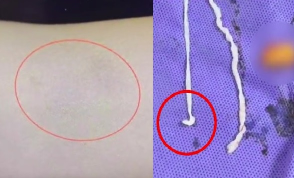 Người phụ nữ đau tay đi kh&aacute;m, b&aacute;c sĩ kinh ngạc khi thấy thứ b&ecirc;n trong - Ảnh 1.