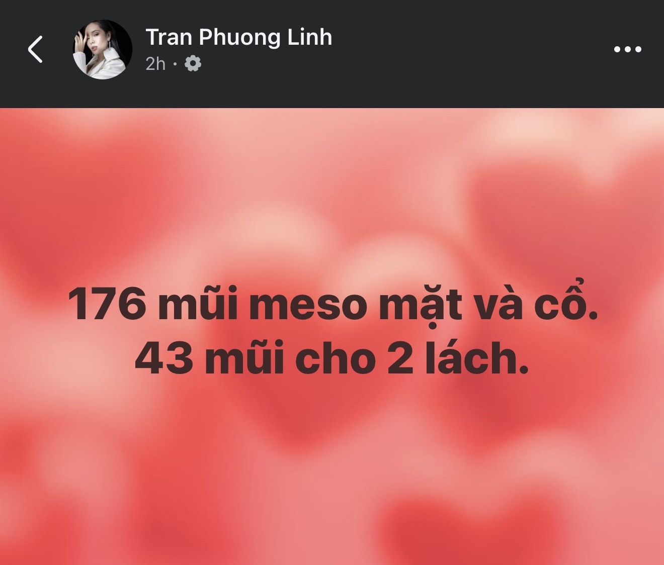 Nữ ca sĩ Việt 42 tuổi tự so m&igrave;nh với Song Hye Kyo, c&ocirc;ng khai 176 mũi ti&ecirc;m tr&ecirc;n mặt v&agrave; 43 mũi ở v&ugrave;ng "kh&oacute; n&oacute;i"- Ảnh 2.
