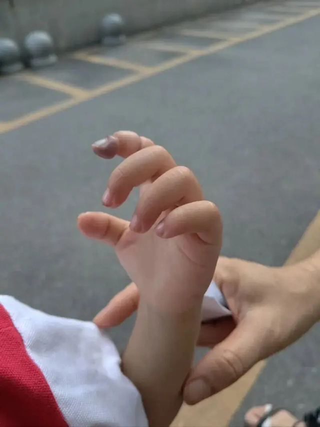 Tỉnh dậy sau giấc ngủ trưa, b&eacute; g&aacute;i 2 tuổi kh&oacute;c th&eacute;t, c&ocirc; gi&aacute;o nh&igrave;n thấy tưởng kh&ocirc;ng sao, cha mẹ lập tức đưa đi viện- Ảnh 2.