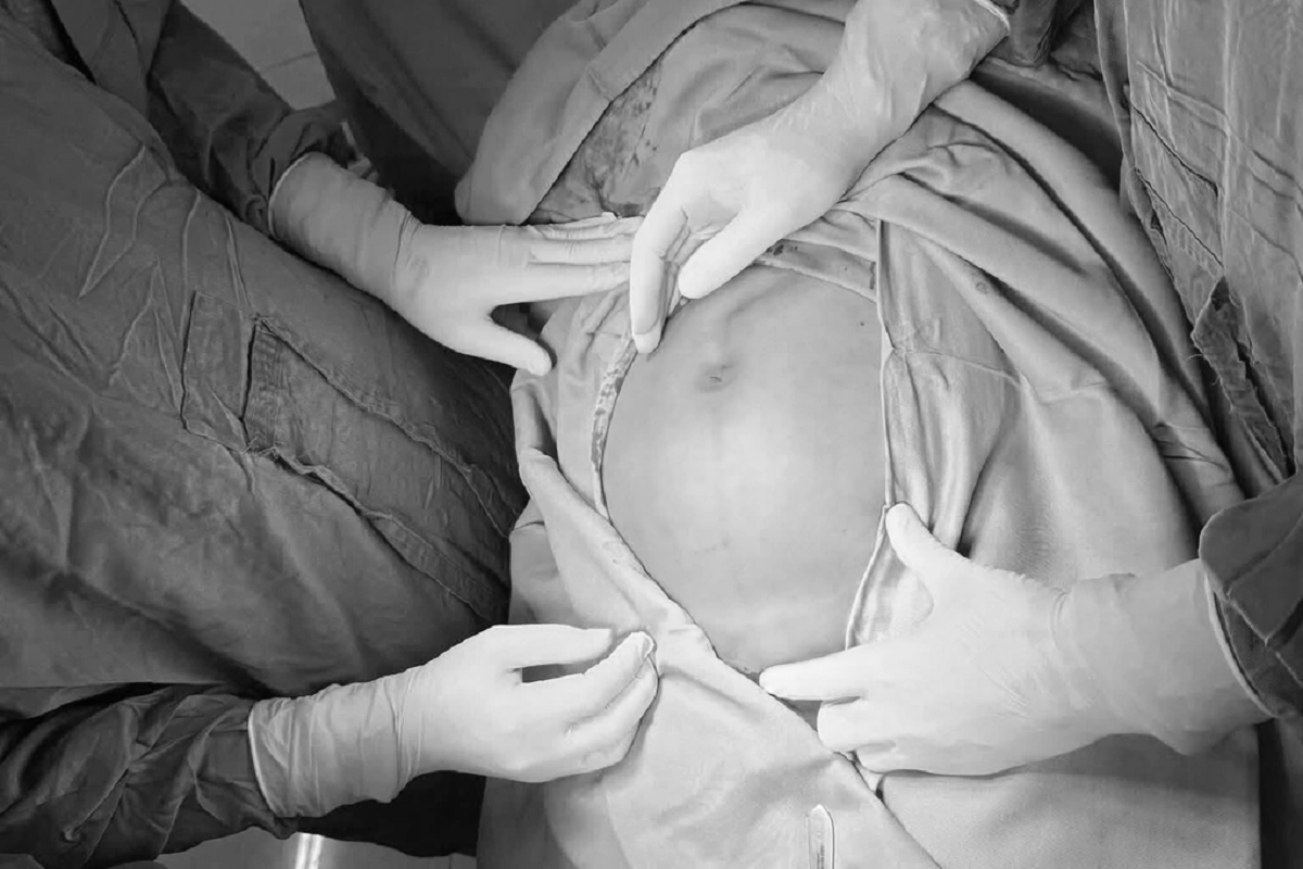Bụng to nhanh bất thường, người phụ nữ "sốc" khi biết b&iacute; mật trong cơ thể - Ảnh 1.